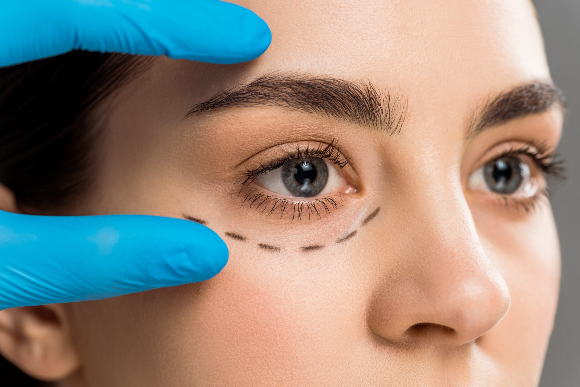 Oculoplasty